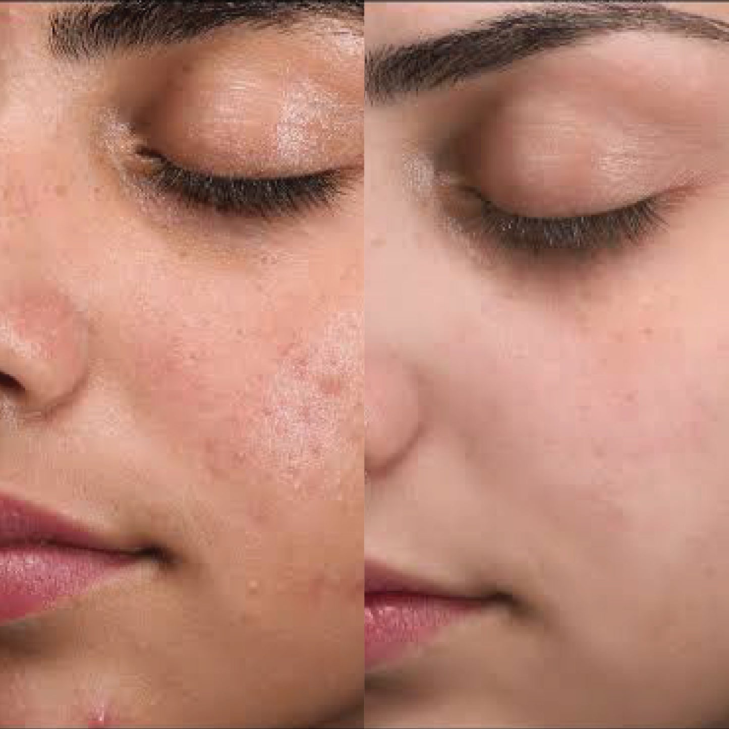 Niacinamide 10% + Zinc 1%